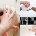 PHÒNG CHỐNG BỆNH DẠI-BỆNH CỰC KỲ NGUY HIỂM